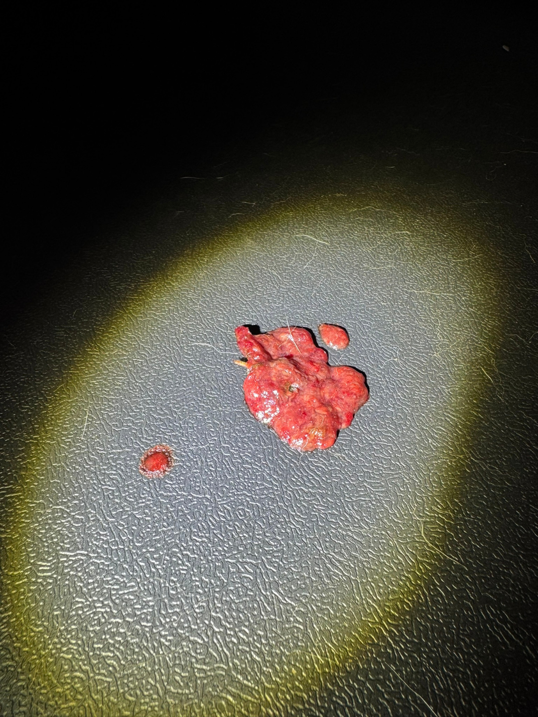 Strawberry jam dog stool, bright red gelatinous appearance of Acute Hemorrhagic Diarrhea Syndrome